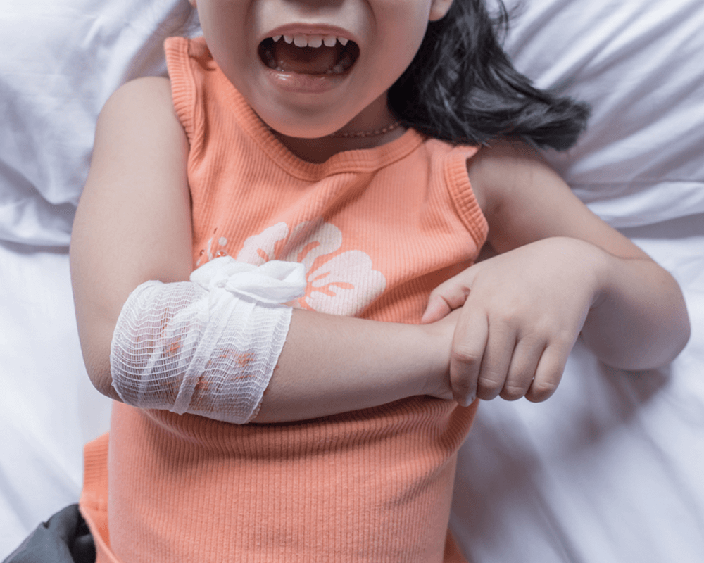 broken bone care