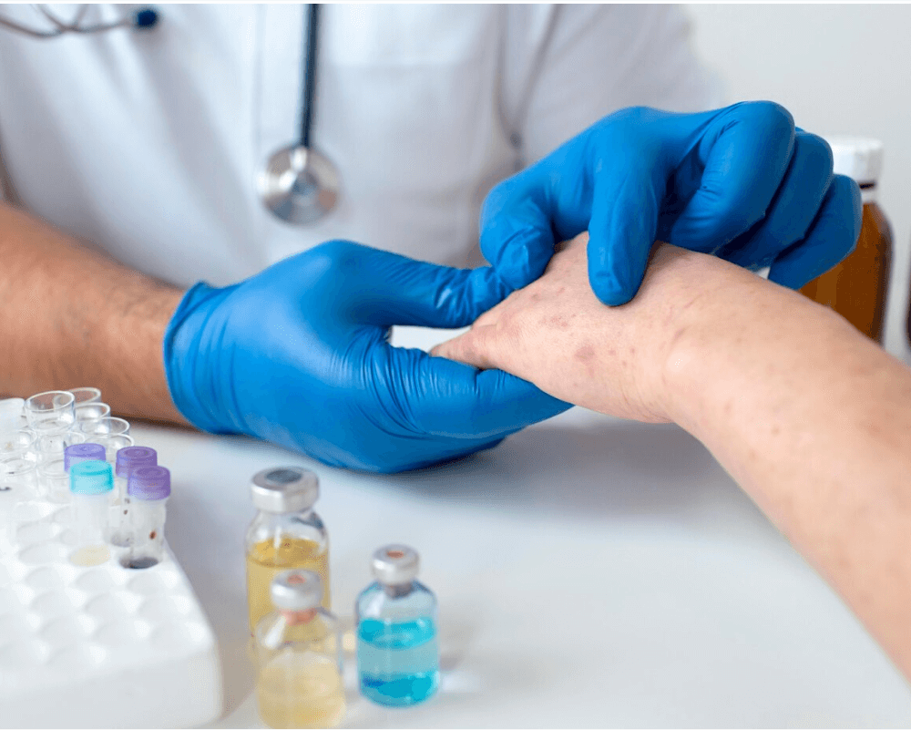 wart removal treatment