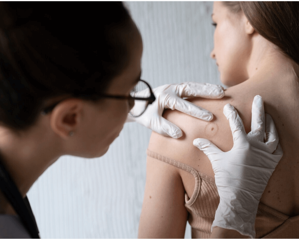 wart removal treatment