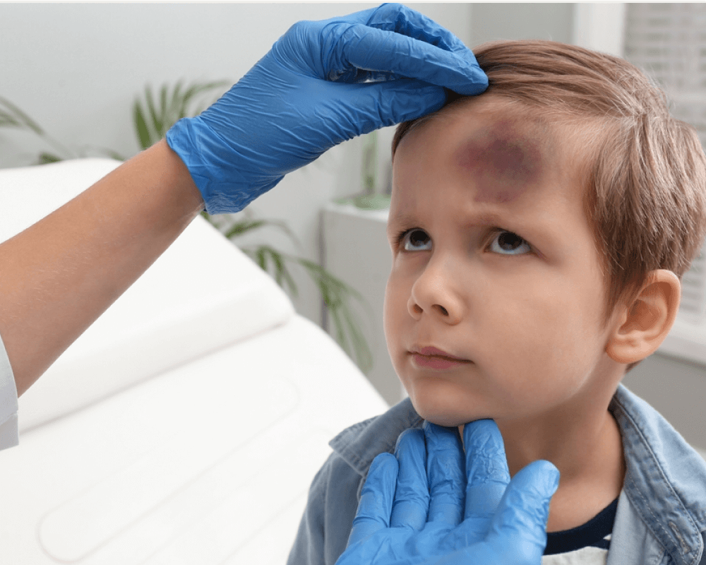 urgent care for skin lacerations