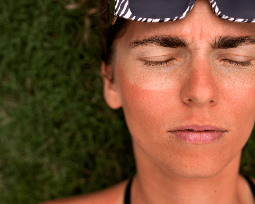 burn treatment