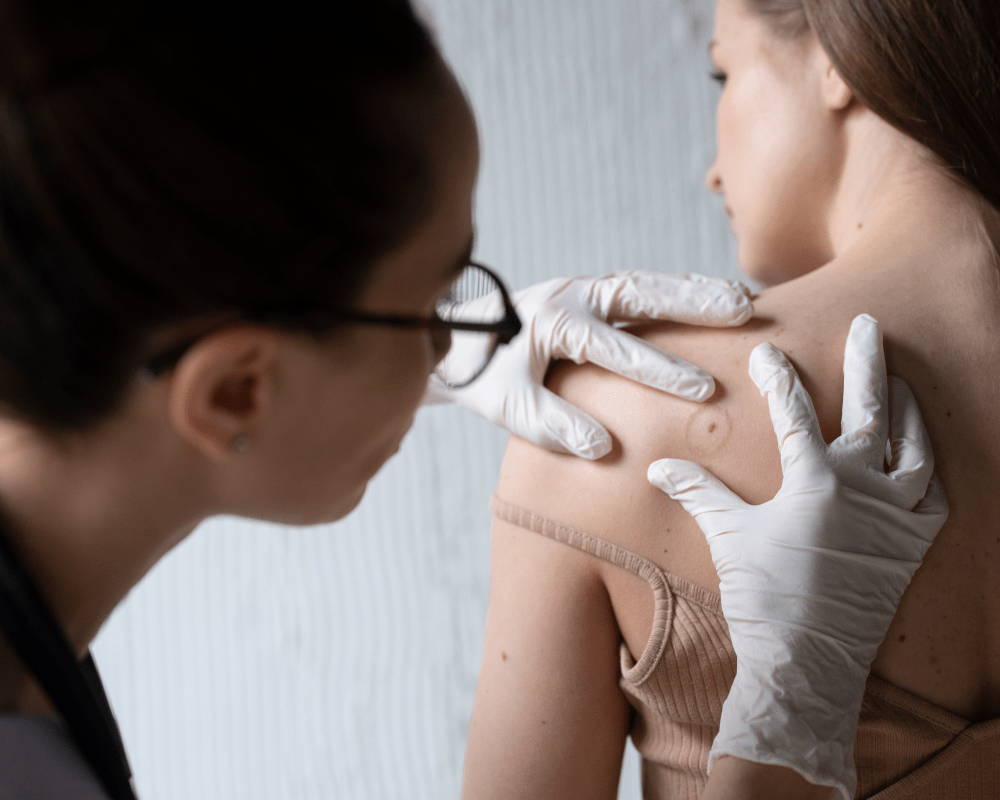 warts and fungal infection treatment