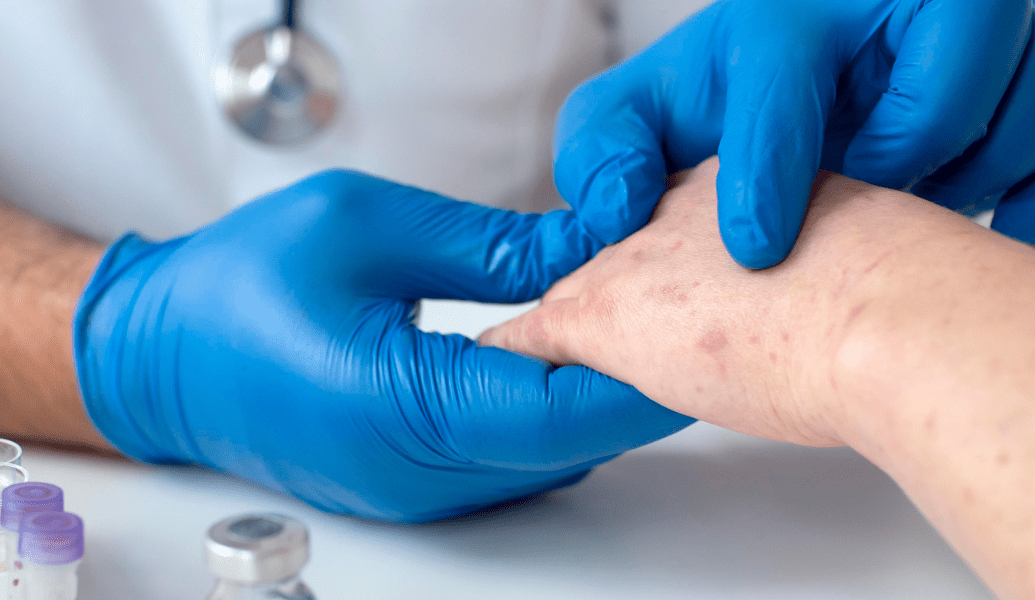 dermatological conditions treatment