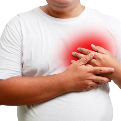What Is Hyperlipidemia? A Beginner’s Guide to High Cholesterol